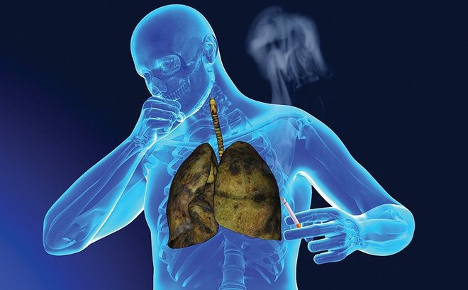 Các bệnh về phổi