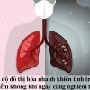 Cảnh báo các bệnh về đường hô hấp do ô nhiễm không khí